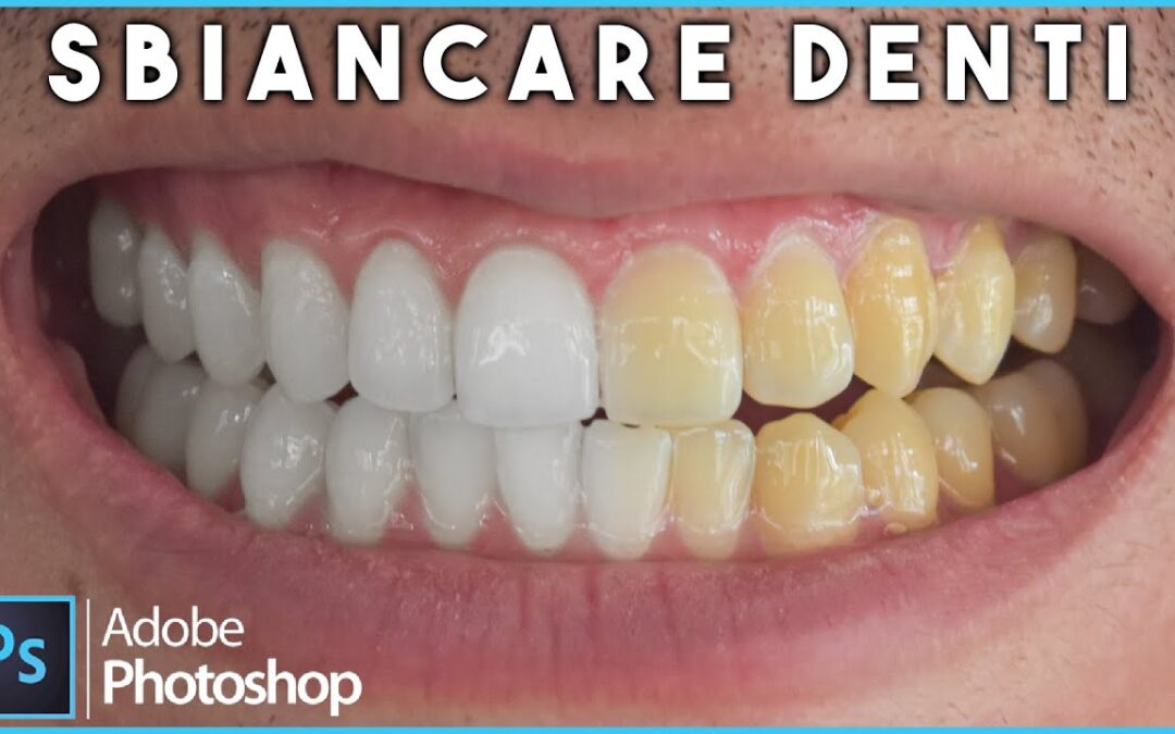 Photoshop: come sbiancare i denti.